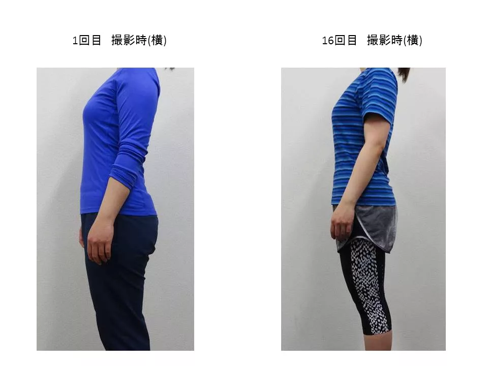 30代女性のお客様の横からの写真