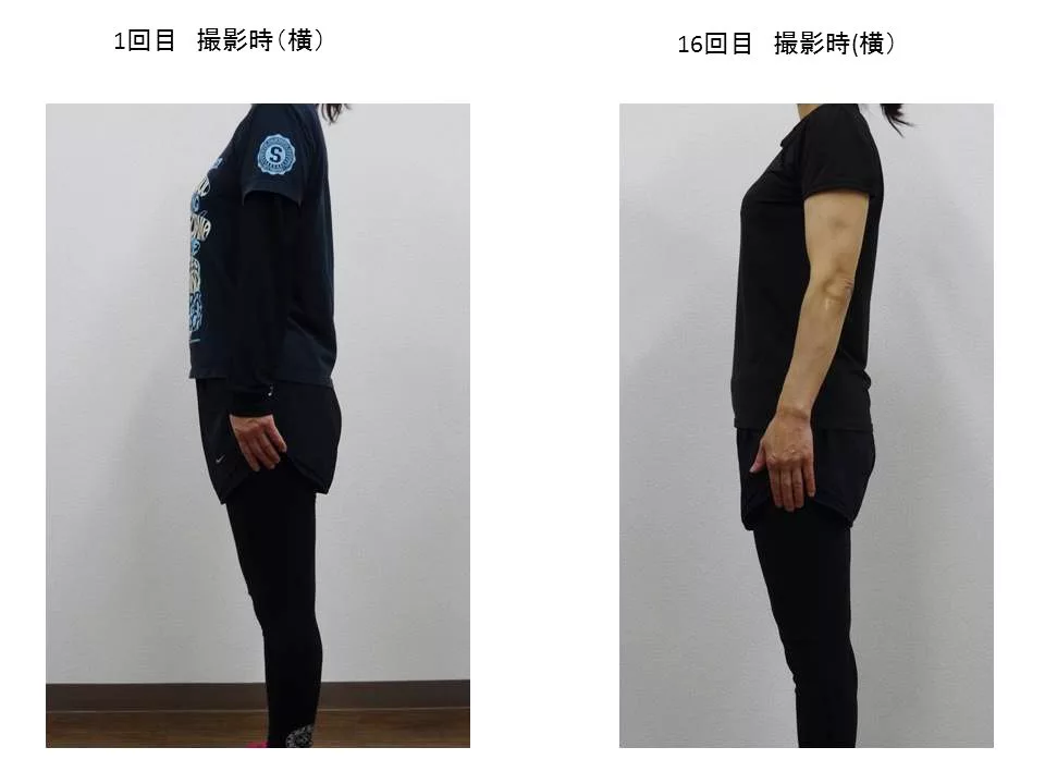 40代女性のお客様の横からの写真