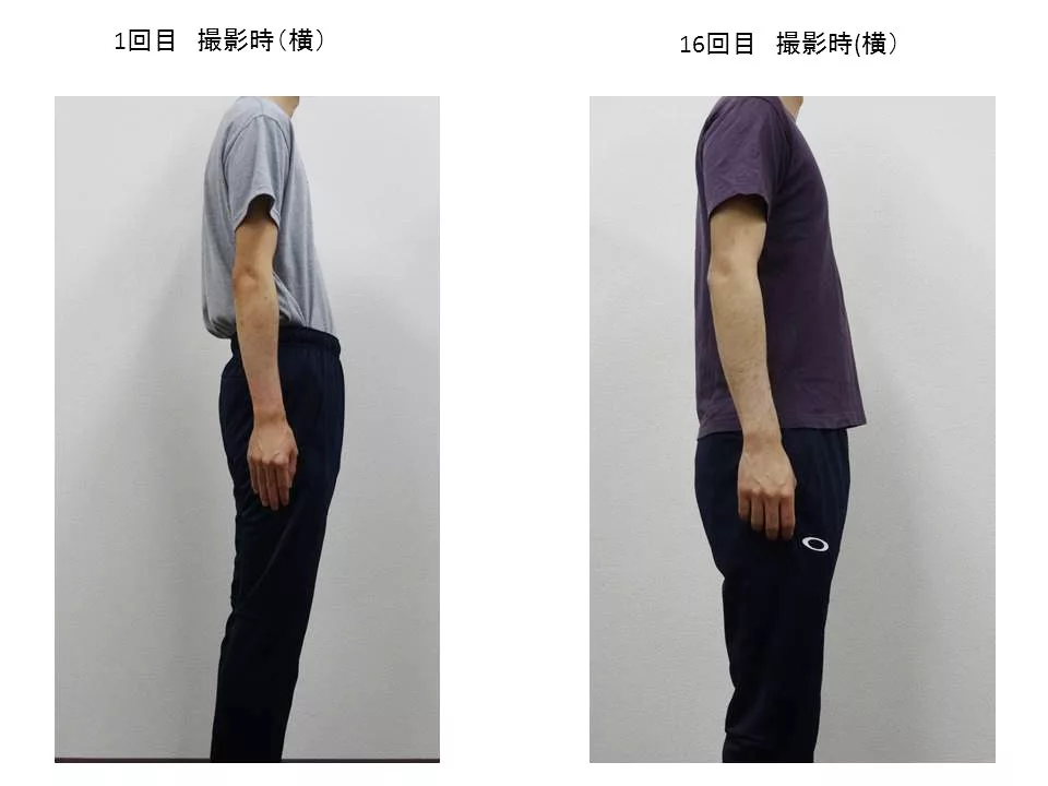 30代男性のお客様の横からの写真