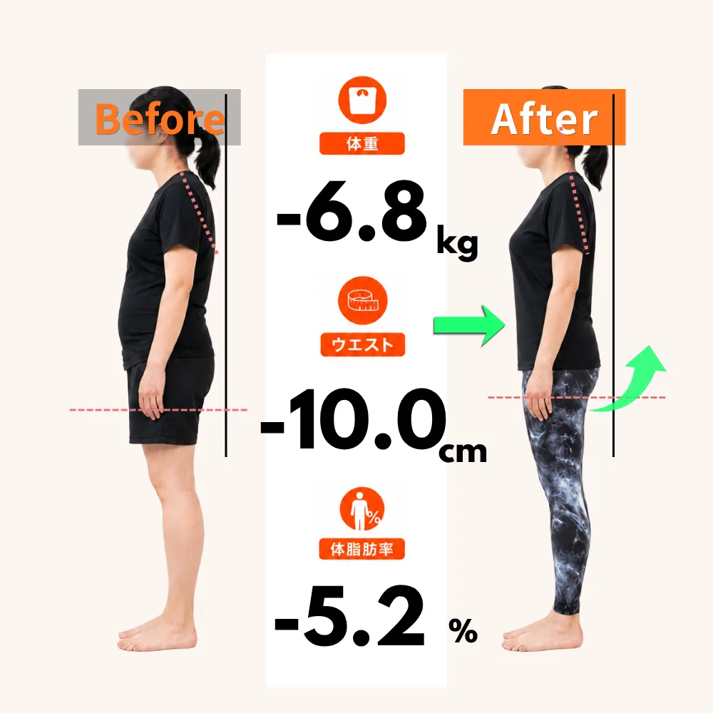 30代女性のお客様のビフォーアフター（モデル）